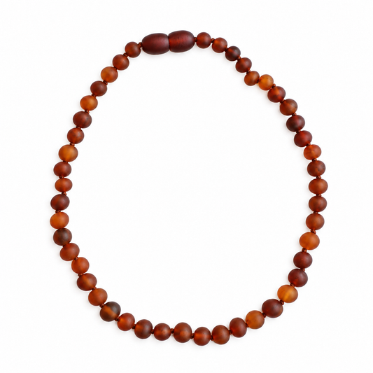 Raw Cognac Baltic Amber Necklace